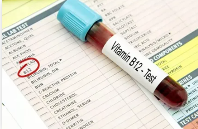 Vitamin B12 Deficiency: Labsys Health Kerala's Diagnostic Solution